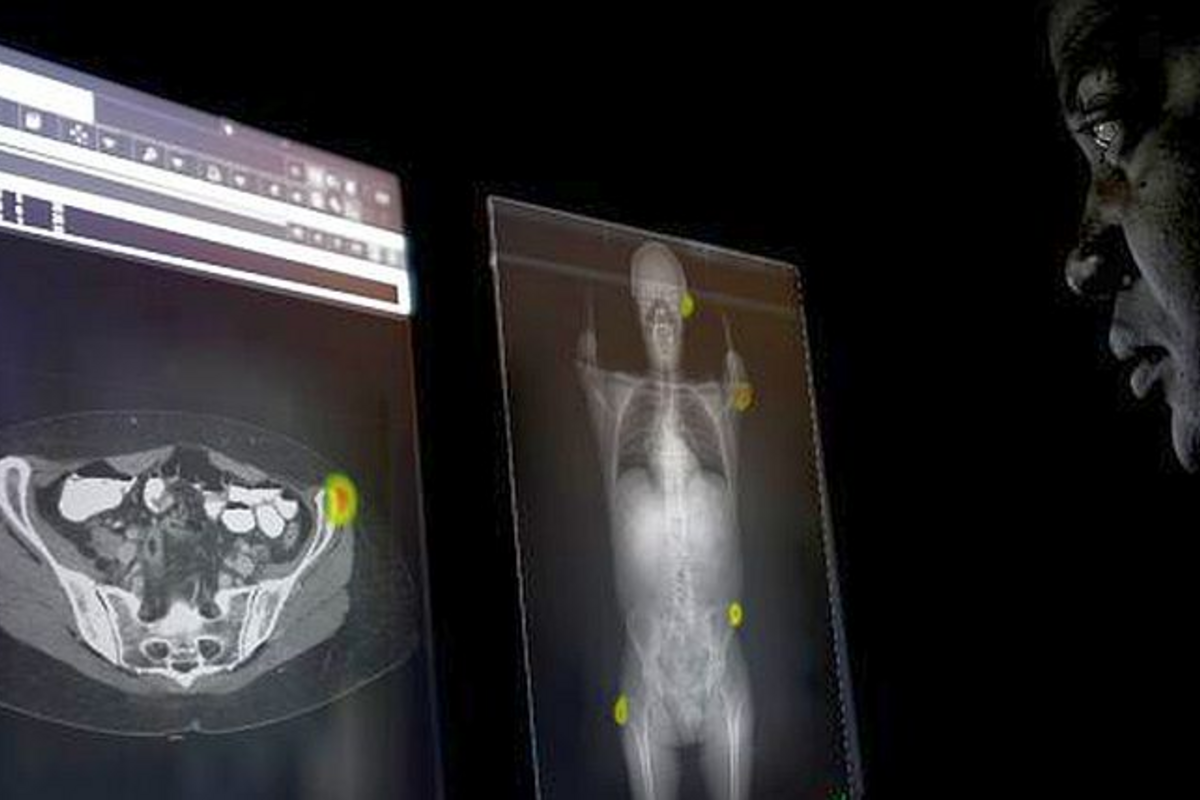 Aidoc Interface Screenshot