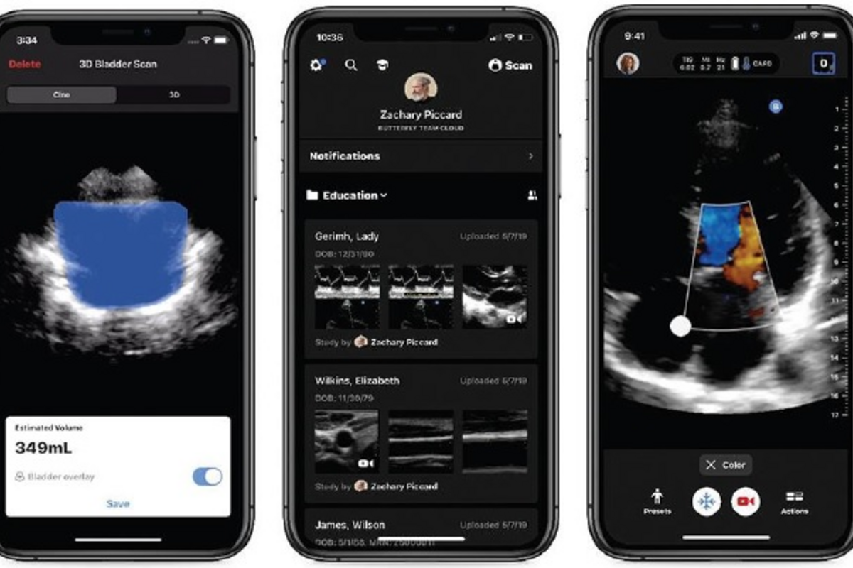 Butterfly iQ Interface Screenshot
