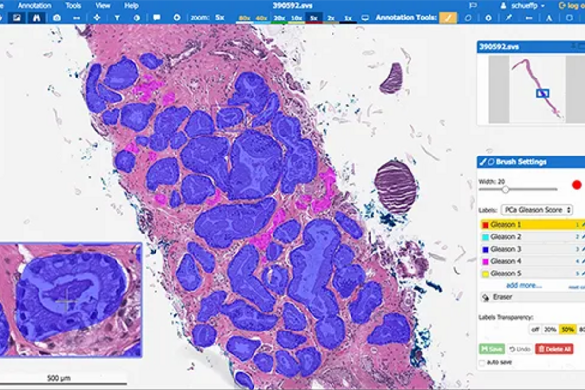 Paige AI Interface Screenshot