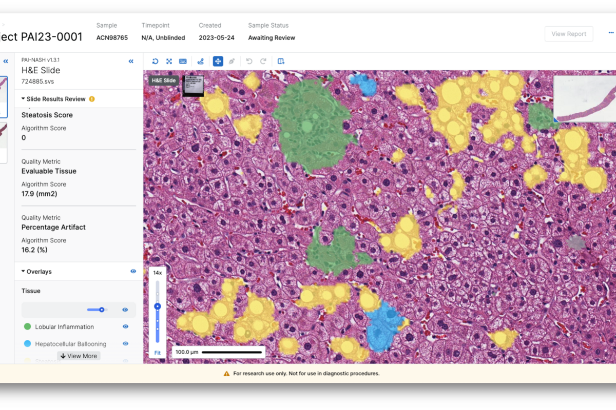 PathAI Interface Screenshot