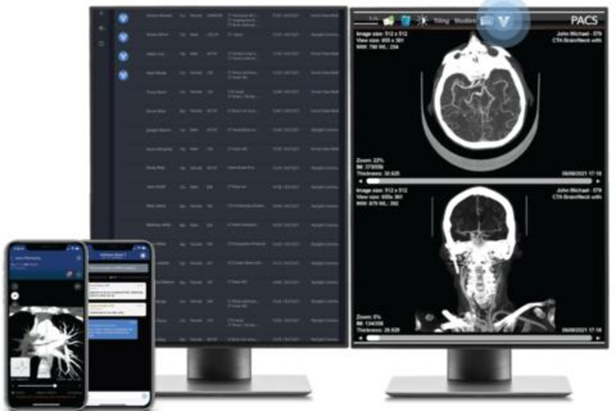Viz.ai Interface Screenshot