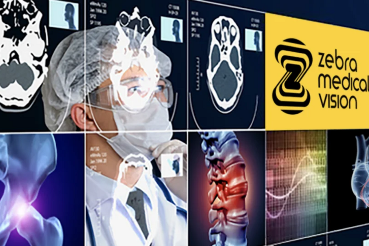 Zebra Medical Vision Interface Screenshot